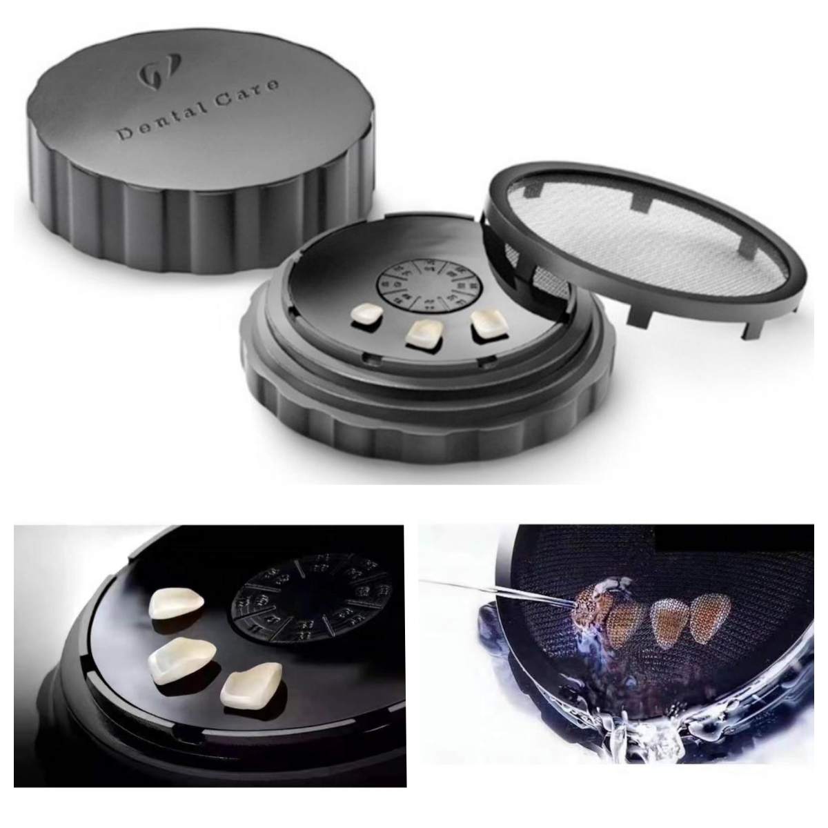 Teeth Whitening Gel For Trays - NIGF Tandheelkundige Fineer Spoelen Spoeldoos Porseleinen