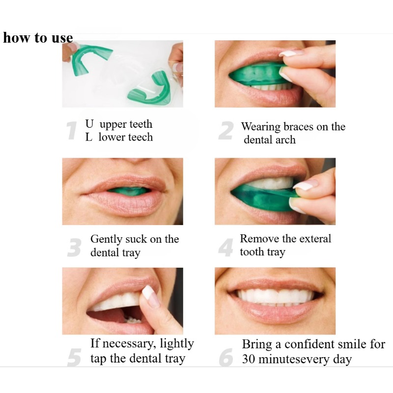 Set Tanden Whitening Lade U-vo - Teeth Whitening Quick recensie en prijs