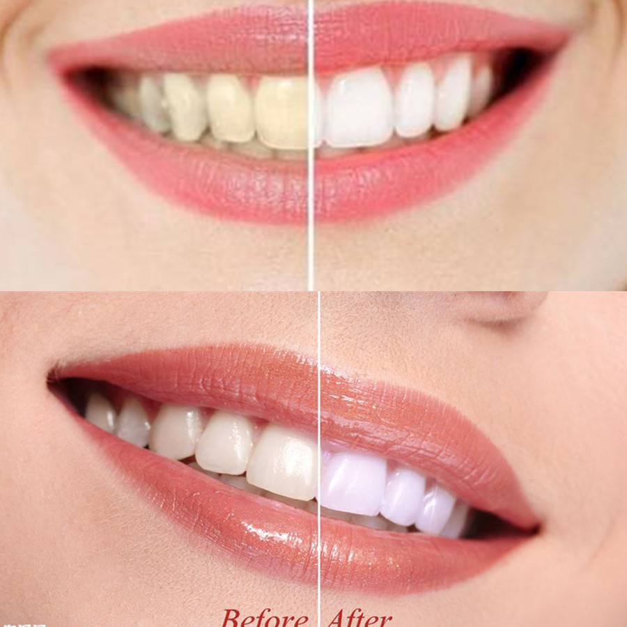 Bamboe Houtskool Tanden Dental - Teeth Whitening Zimba recensie en prijs