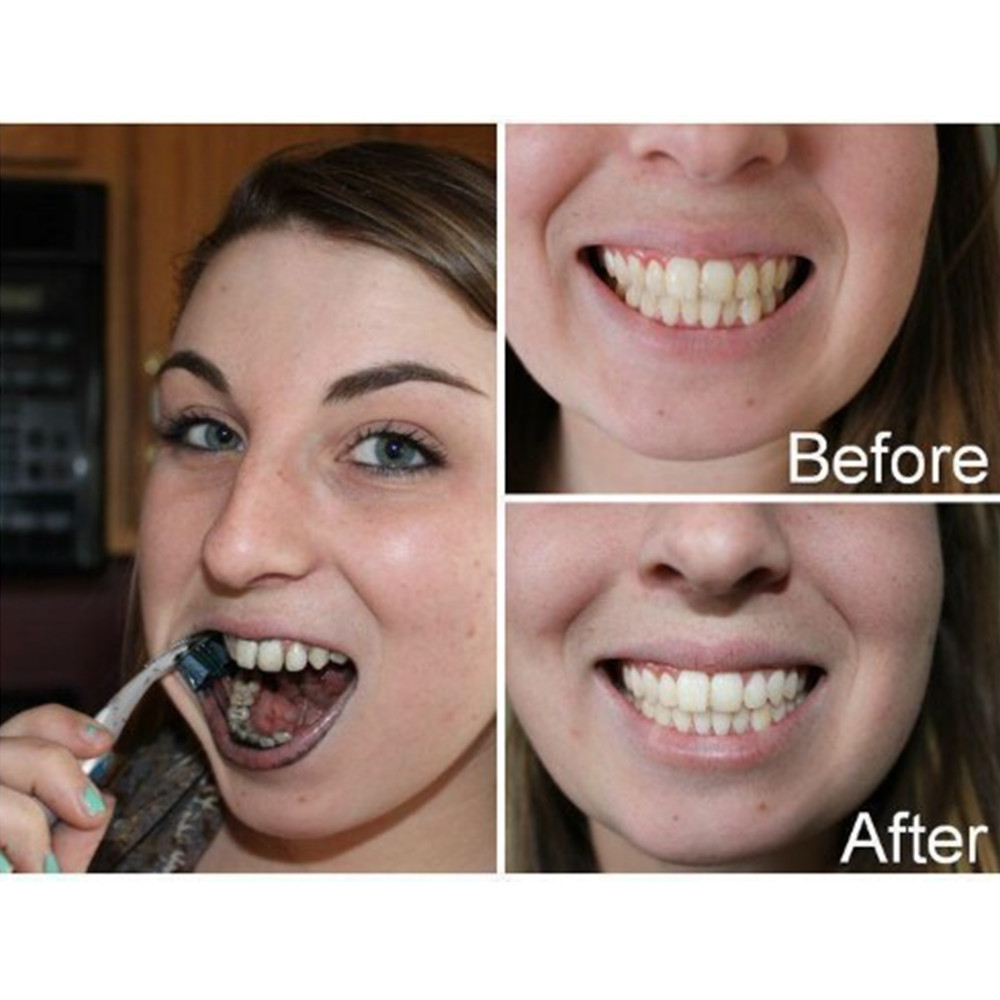 Bamboe Houtskool Tanden Dental - Teeth Whitening Zimba recensie en prijs