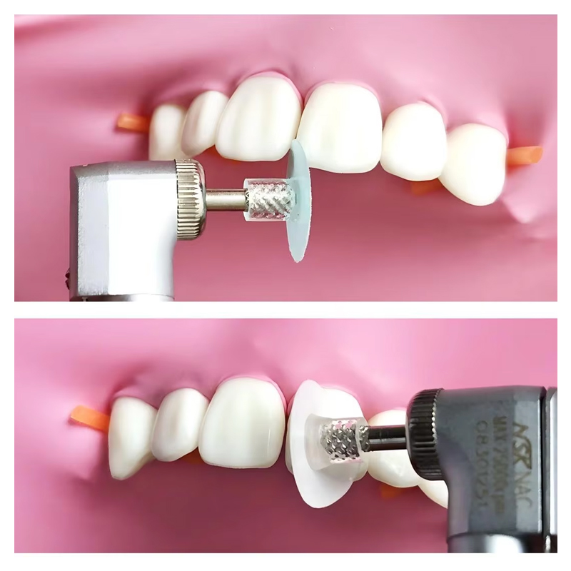 40 Stuks Tandheelkundige Polij - Teeth Whitening Home recensie en prijs