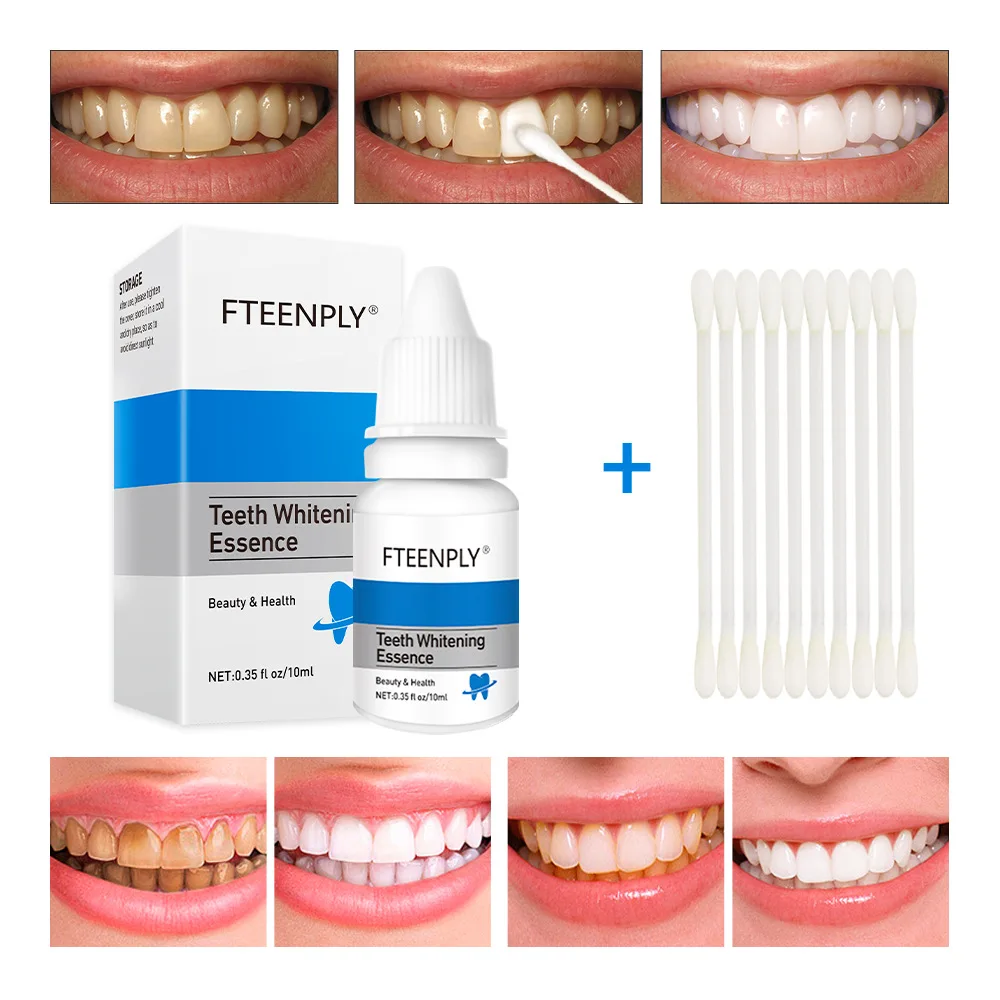 Fteenply Tanden Whitening Esse - Teeth Whitening Zimba recensie en prijs