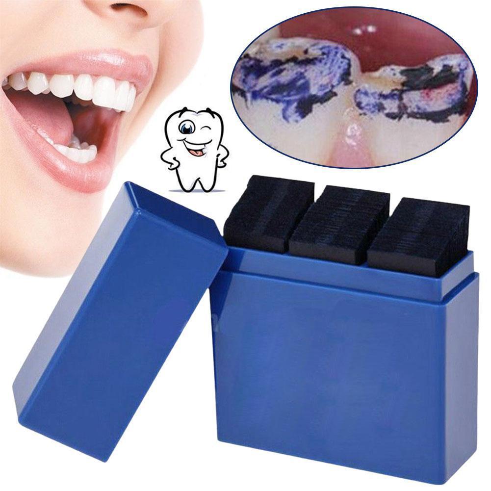 300 Vellen Tandheelkundige Art - Teeth Whitening Home recensie en prijs