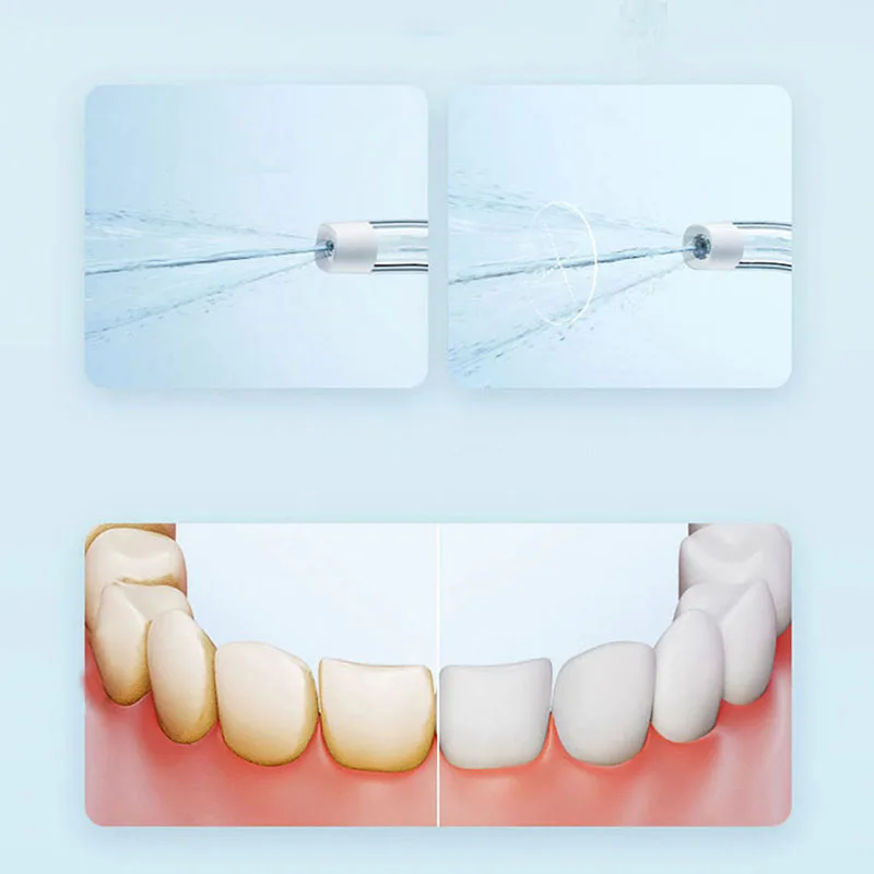 Xiaomi Draagbare Monddouche F3 - Teeth Whitening Quick recensie en prijs