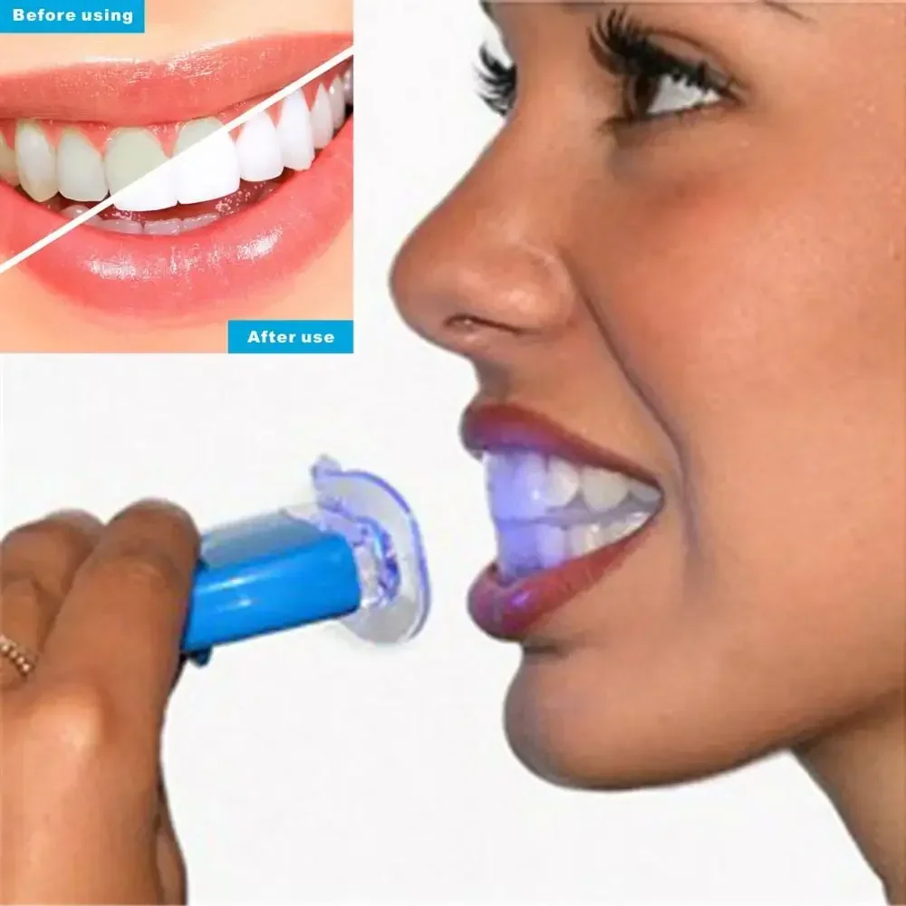 USB Quick Charge baard- en lic - Teeth Whitening Quick recensie en prijs