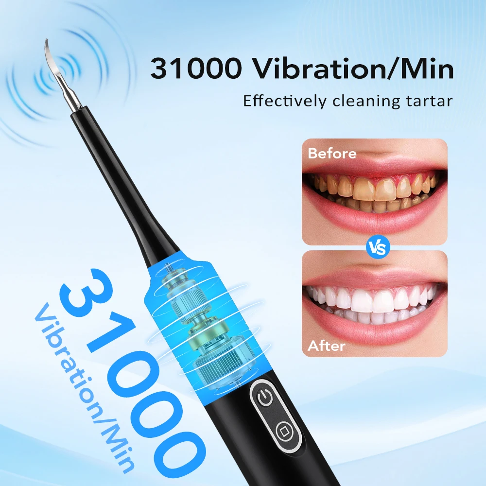Elektrische sonische vibratie  - Teeth Whitening Home recensie en prijs